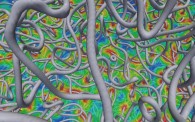 Cosmic Strings