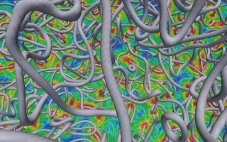 Cosmic Strings