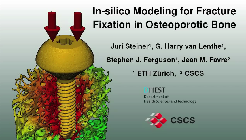 Scientific Visualization: In-Silico Modeling for Fracture Fixation in Osteoporotic Bone